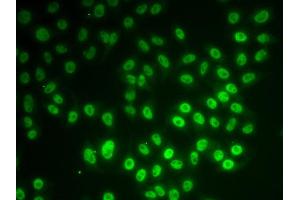 Immunofluorescence analysis of MCF7 cell using SNRPD1 antibody. (SNRPD1 抗体)