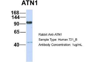 Host: Rabbit Target Name: ATN1 Sample Type: 721_B Antibody Dilution: 1. (Atrophin 1 抗体  (N-Term))
