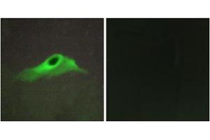 Immunofluorescence analysis of HeLa cells, using COL4A5 antibody. (COL4a5 抗体  (N-Term))