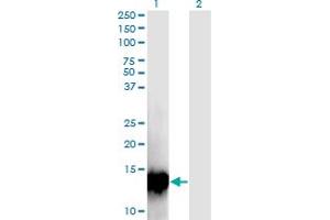 Western Blot analysis of C17orf37 expression in transfected 293T cell line by C17orf37 monoclonal antibody (M09), clone 4D4. (C17orf37 抗体  (AA 1-115))