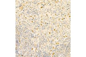 Immunohistochemistry of paraffin embedded rat spleen using RAPGEF5 (ABIN7075365) at dilution of 1:700 (400x lens) (GFR 抗体)