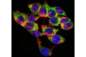 Immunocytochemistry (ICC) image for anti-Lipoprotein (Lp(a)) (AA 4330-4521) antibody (ABIN1845714) (Lp(a) 抗体  (AA 4330-4521))