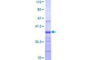 PLA2G15 Protein (AA 314-412) (GST tag)