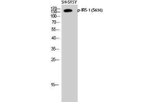 Western Blot (WB) analysis of SH-SY5Y cells using Phospho-IRS-1 (S636) Polyclonal Antibody. (IRS1 抗体  (pSer636))