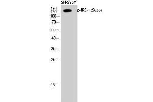 Western Blot (WB) analysis of SH-SY5Y cells using Phospho-IRS-1 (S636) Polyclonal Antibody.