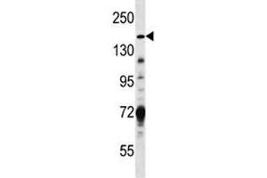Hamartin antibody western blot analysis in MDA-MB231 lysate