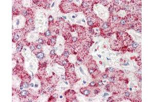 Anti-AIG1 antibody IHC staining of human liver. (AIG1 抗体  (N-Term))