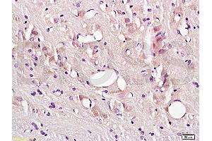 Formalin-fixed and paraffin embedded rat brain tissue labeled with Anti-CD54/ICAM-1 Polyclonal Antibody (ABIN670806), Unconjugated at 1:200, followed by conjugation to the secondary antibody and DAB staining (ICAM1 抗体  (AA 201-300))