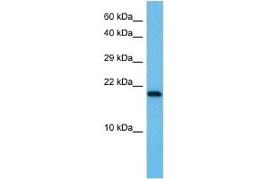 Host:  Mouse  Target Name:  UBE2I  Sample Tissue:  Mouse Testis  Antibody Dilution:  1ug/ml (UBE2I 抗体  (N-Term))