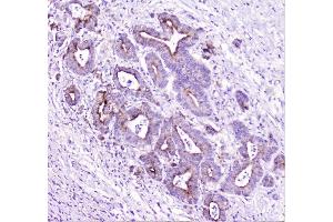 IHC analysis of TANK using anti-TANK antibody (ABIN6719508). (TANK 抗体)