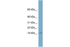 WB Suggested Anti-NOLA3  Antibody Titration: 0. (Nop10 抗体  (Middle Region))