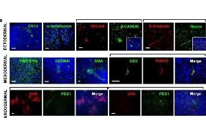 Immunofluorescence (Paraffin-embedded Sections) (IF (p)) image for anti-Keratin 14 (KRT14) antibody (ABIN2855778)