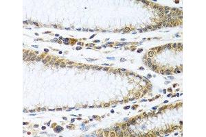 Immunohistochemistry of paraffin-embedded Human stomach using IFI44 Polyclonal Antibody at dilution of 1:100 (40x lens).