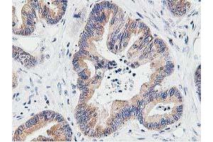 Image no. 10 for anti-Leucine Carboxyl Methyltransferase 1 (LCMT1) antibody (ABIN1499107) (LCMT1 抗体)