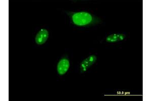 Immunofluorescence of purified MaxPab antibody to BYSL on HeLa cell. (Bystin-Like 抗体  (AA 1-437))