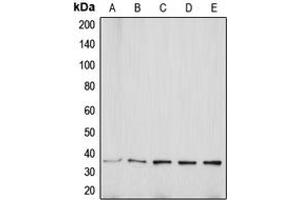 Western blot analysis of Aquaporin 5 expression in MCF7 (A), Jurkat (B), SP2/0 (C), PC12 (D), KNRK (E) whole cell lysates. (Aquaporin 5 抗体  (C-Term))