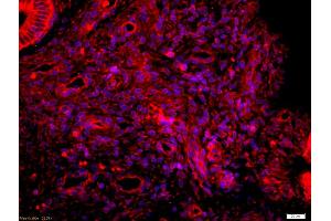 Formalin-fixed and paraffin embedded Human endometrium labeled with Anti-phospho-Tau protein(Ser396) Polyclonal Antibody, Unconjugated (ABIN746453) at 1:200 followed by conjugation to the secondary antibody Goat Anti-Rabbit IgG, Cy3 conjugated used at 1:200 dilution for 40 minutes at 37°C and DAPI staining (tau 抗体  (pSer396))