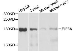 Western blot analysis of extracts of A2058 cell line, using EIF3A antibody. (EIF3A 抗体  (AA 1-250))