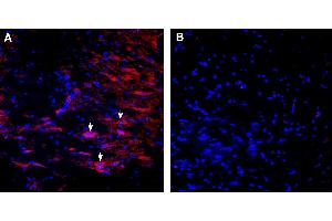 Expression of nAChRα7 in in rat substantia nigra pars compacta (SNC).