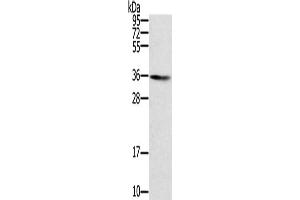 Gel: 8 % SDS-PAGE, Lysate: 40 μg, Lane: Human normal liver tissue, Primary antibody: ABIN7131123(SNX11 Antibody) at dilution 1/300, Secondary antibody: Goat anti rabbit IgG at 1/8000 dilution, Exposure time: 5 minutes (SNX11 抗体)
