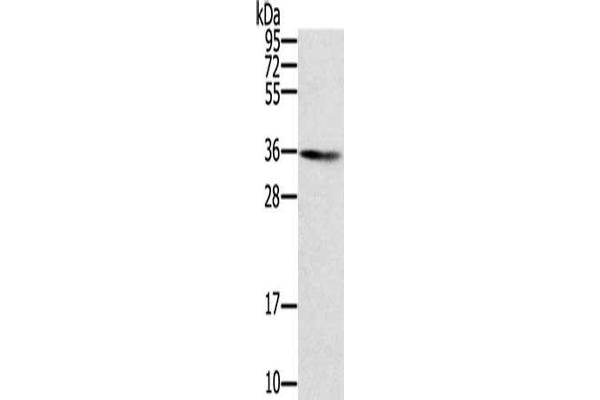 SNX11 anticorps