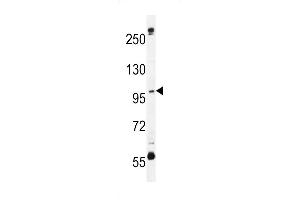 C Antibody (N-term) (ABIN654933 and ABIN2844576) western blot analysis in MDA-M cell line lysates (35 μg/lane). (SWT1 抗体  (N-Term))