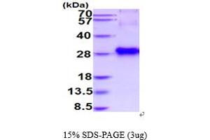SDS-PAGE (SDS) image for Retinaldehyde Binding Protein 1 (RLBP1) (AA 1-317) protein (His tag) (ABIN5854662) (RLBP1 Protein (AA 1-317) (His tag))