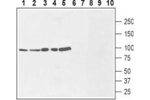 Western blot analysis of rat brain membranes (lanes 1 and 6), mouse brain lysate (lanes 2 and 7), human MCF-7 breast adenocarcinoma cells (lanes 3 and 8), human U-87 MG glioblastoma cells (lanes 4 and 9) and human THP-1 acute monocytic leukemia cells (lanes 5 and 10): - 1-5. (SLC9A1 抗体  (1st Extracellular Loop))