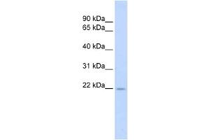 WB Suggested Anti-TNFSF18 Antibody Titration:  0. (TNFSF18 抗体  (Middle Region))