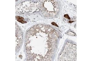 Immunohistochemical staining of human testis with CXXC5 polyclonal antibody  shows strong cytoplasmic positivity in Leydig cells. (CXXC5 抗体)