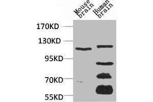Western blot analysis of 1) Mouse Brain Tissue, 2)Human Brain Tissue, with CaVα2δ3 Rabbit pAb diluted at 1:2,000.