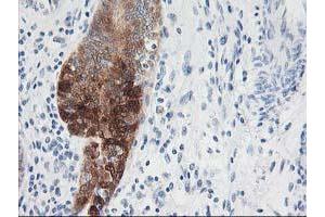 Image no. 5 for anti-NudE Nuclear Distribution E Homolog (A. Nidulans)-Like 1 (NDEL1) antibody (ABIN1499853)