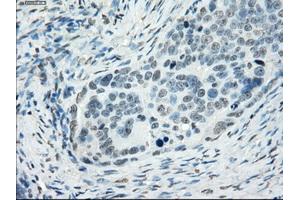 Immunohistochemical staining of paraffin-embedded colon tissue using anti-SSX2mouse monoclonal antibody. (SSX2 抗体)
