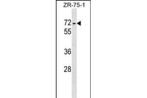 ZKSCAN1 Antibody (Center) (ABIN1538154 and ABIN2848860) western blot analysis in ZR-75-1 cell line lysates (35 μg/lane). (ZKSCAN1 抗体  (AA 238-265))