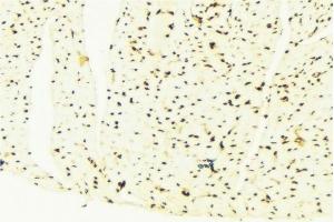 ABIN6276361 at 1/100 staining Mouse liver tissue by IHC-P. (CDKN1B 抗体  (Internal Region))