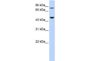 WB Suggested Anti-DPH2 Antibody Titration: 0. (DPH2 抗体  (N-Term))