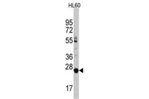 Image no. 1 for anti-Lin-28 Homolog B (LIN28B) (C-Term) antibody (ABIN357012) (LIN28B 抗体  (C-Term))