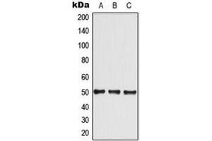 Western blot analysis of GLUT4 expression in A549 (A), HeLa (B), NIH3T3 (C) whole cell lysates. (GLUT4 抗体  (Center))