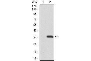 Western blot analysis using RAG1 mAb against HEK293 (1) and RAG1 (AA: 818-868)-hIgGFc transfected HEK293 (2) cell lysate. (RAG1 抗体  (AA 818-868))