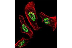 Immunofluorescence (IF) image for anti-Nuclear Receptor Subfamily 2, Group C, Member 2 (NR2C2) (AA 438-466), (C-Term) antibody (ABIN1537335)
