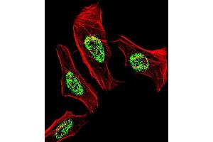 Fluorescent confocal image of Hela cell stained with NR2C2 Antibody (C-term) (ABIN1537335 and ABIN2838328). (TR4 抗体  (C-Term))