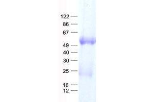 Validation with Western Blot (ILK Protein (His tag))