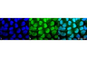 Immunocytochemistry/Immunofluorescence analysis using Rabbit Anti-Methylated Lysine Polyclonal Antibody . (Lysine (lys) (methylated) 抗体 (Biotin))