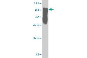 Western Blot detection against Immunogen (82. (STK33 抗体  (AA 1-514))