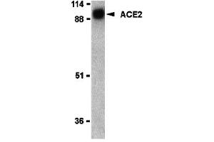 Western Blotting (WB) image for anti-Angiotensin I Converting Enzyme 2 (ACE2) (N-Term) antibody (ABIN1031210) (ACE2 抗体  (N-Term))