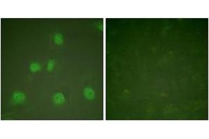 Immunofluorescence analysis of HeLa cells, using Cullin 1 Antibody. (Cullin 1 抗体  (AA 727-776))