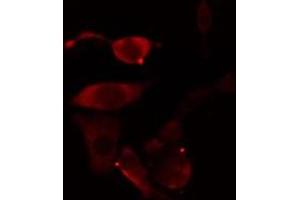 ABIN6277002 staining Hela cells by IF/ICC. (TBXAS1 抗体  (N-Term))