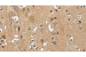 Immunohistochemistry of paraffin-embedded Human brain tissue using PITX3 Polyclonal Antibody at dilution 1:40 (PITX3 抗体)