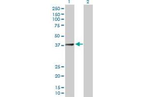 Western Blot analysis of SUCLG2 expression in transfected 293T cell line by SUCLG2 MaxPab polyclonal antibody. (SUCLG2 抗体  (AA 1-384))