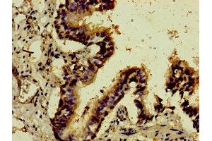 Immunohistochemistry of paraffin-embedded human lung tissue using ABIN7148789 at dilution of 1:100 (ATF3 抗体  (AA 1-181))